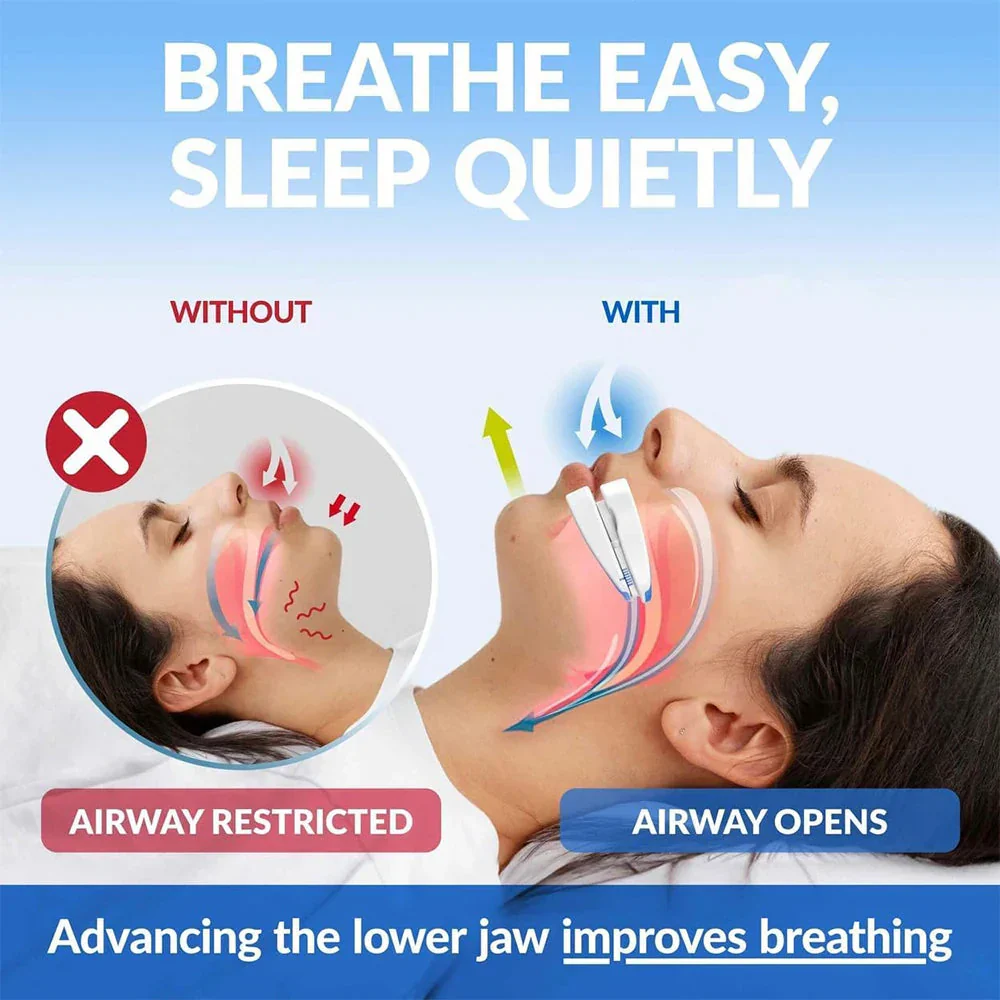 Anti-Snoring Mouthpiece – Adjustable Night Mouth Guard for Snoring - Image 2