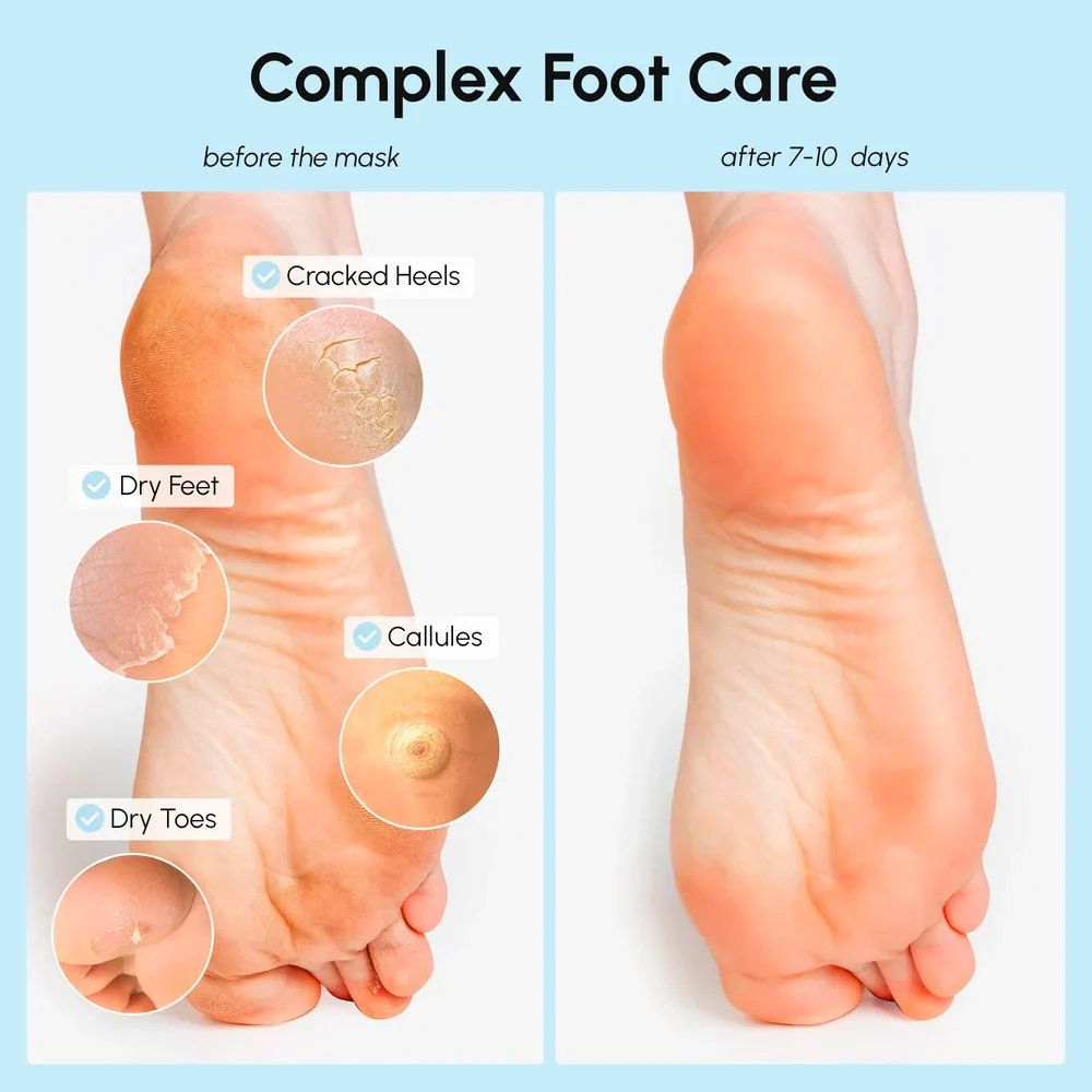 Exfoliating & Hydrating Foot Mask - Image 3