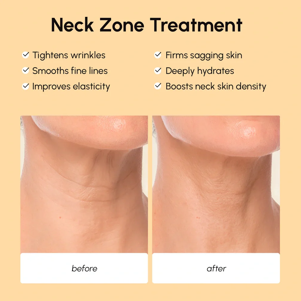 Lifting Neck Wrinkle Patches - Image 3