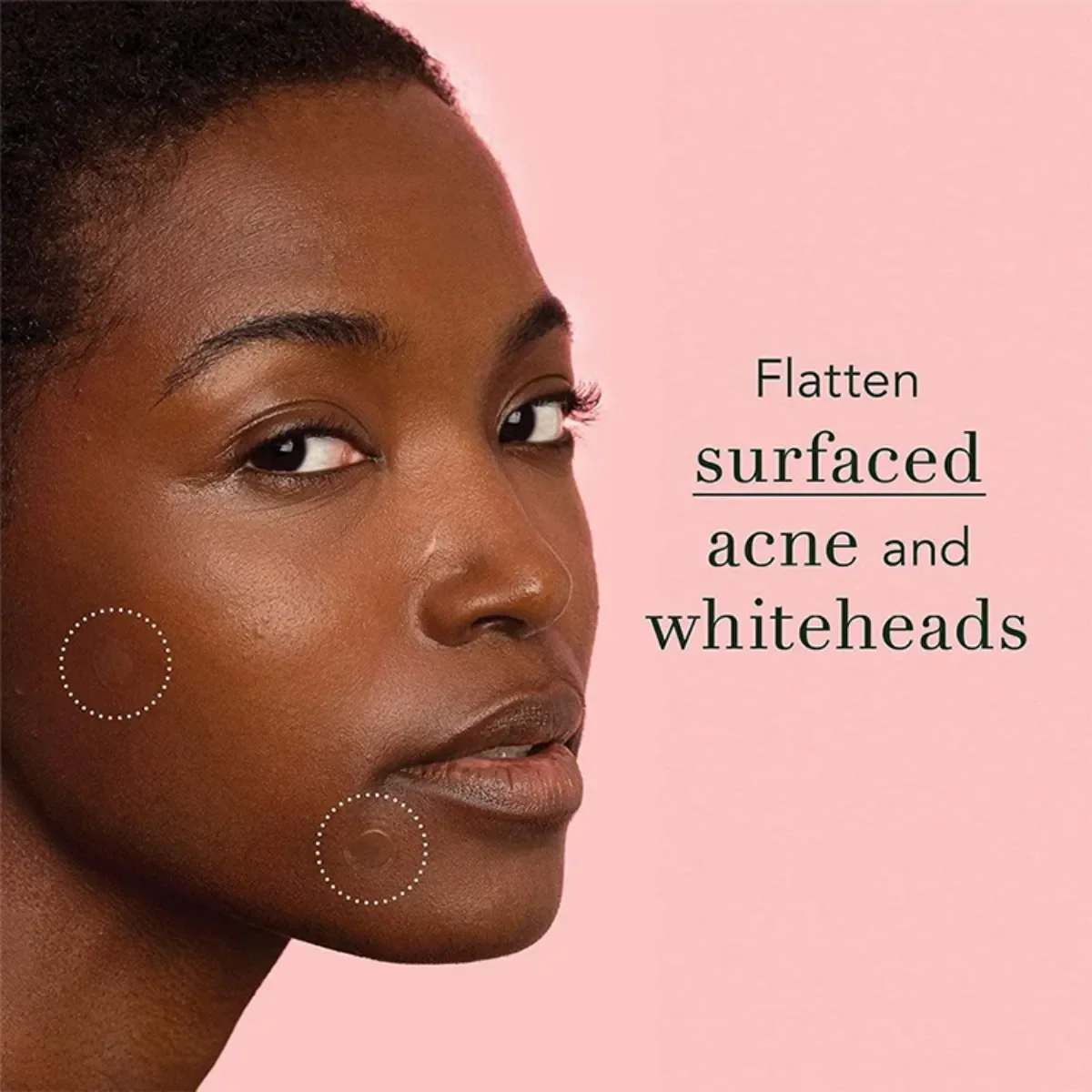 Ultra-Thin Waterproof Acne Spot Patches - Image 6